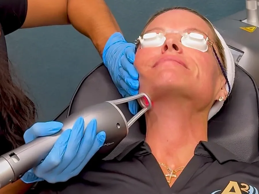 A2 provider performing a NOUVADerm laser treatment in Tampa